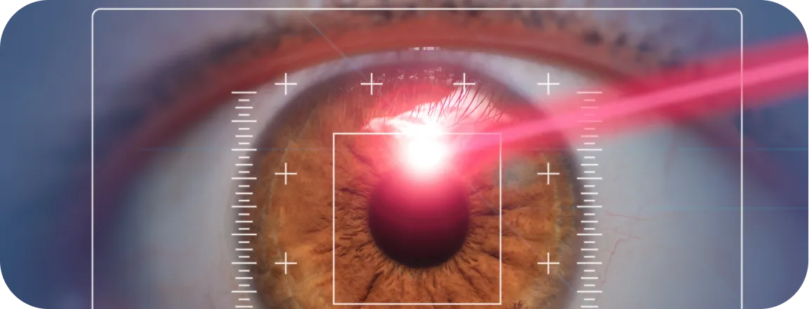 Yag Laser