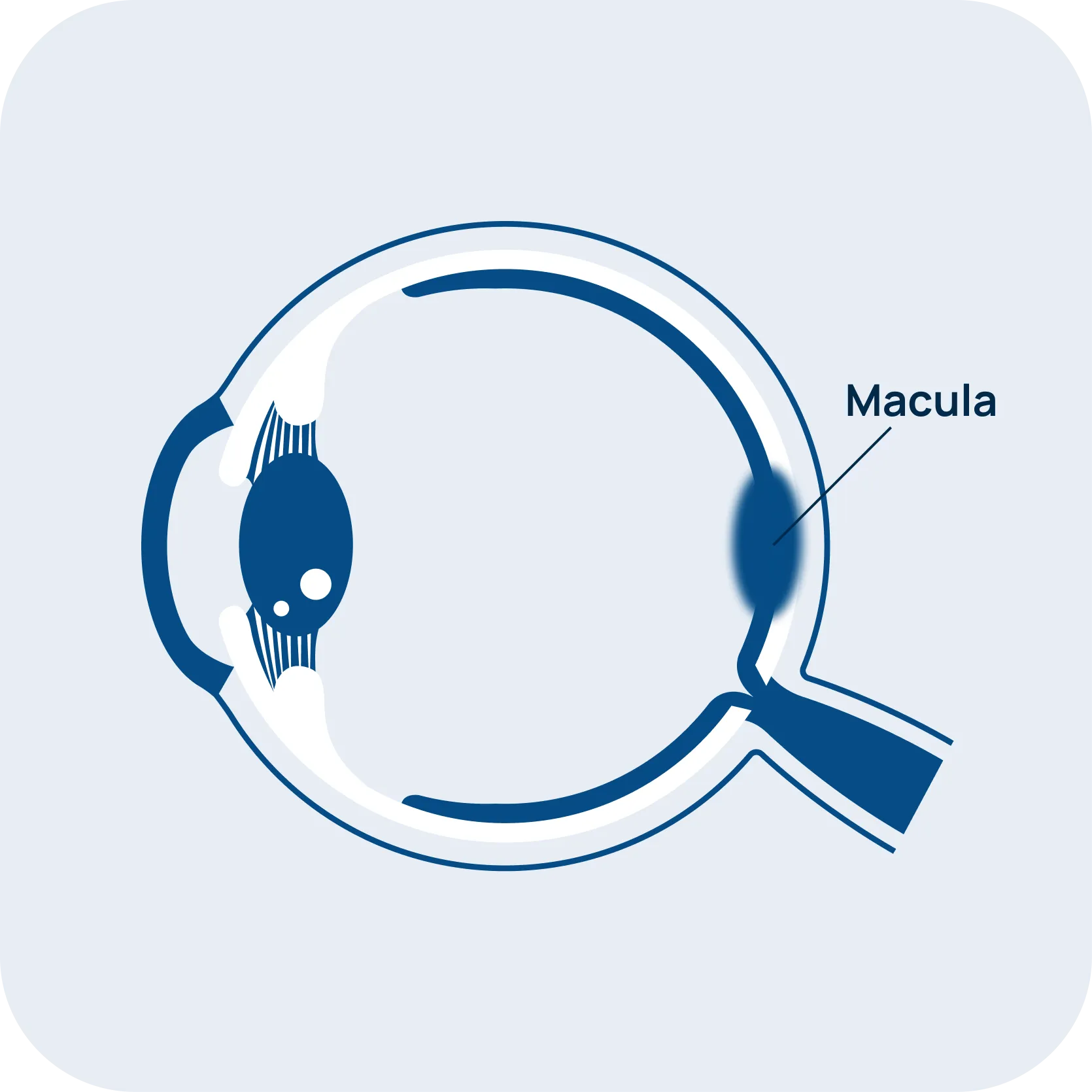 Occhio maculopatia