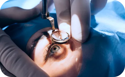 Visita oculistica