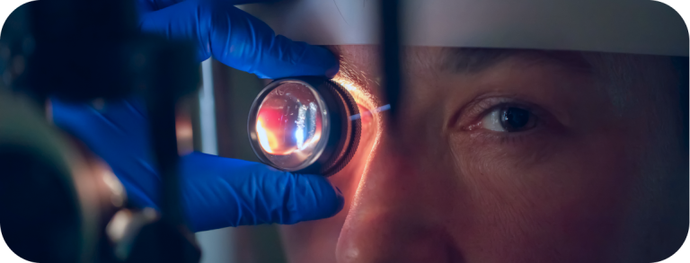 Esame del fondo dell'occhio con lente durante una visita oculistica in Edoria Vision a Torino